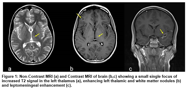 crypto mri