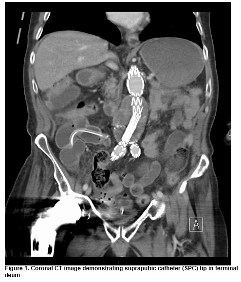 Infected Suprapubic Catheter